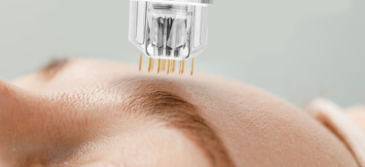 올리고펩타이드 페이스 스킨 리페어 마이크로 니들 세럼  - Hyaluronic Acid Facial Serum 리뷰 및 가격