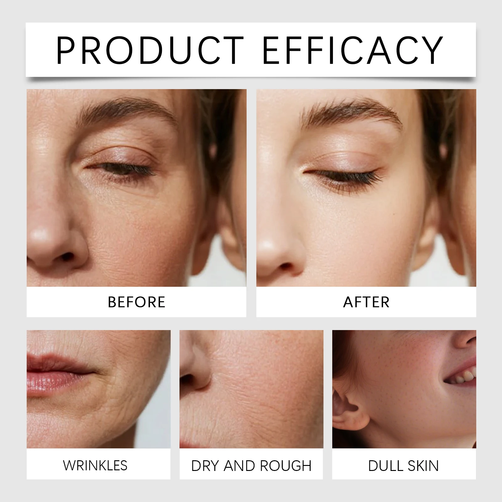 올리고펩타이드 페이스 스킨 리페어 마이크로 니들 세럼  - Hyaluronic Acid Facial Serum 리뷰 및 가격