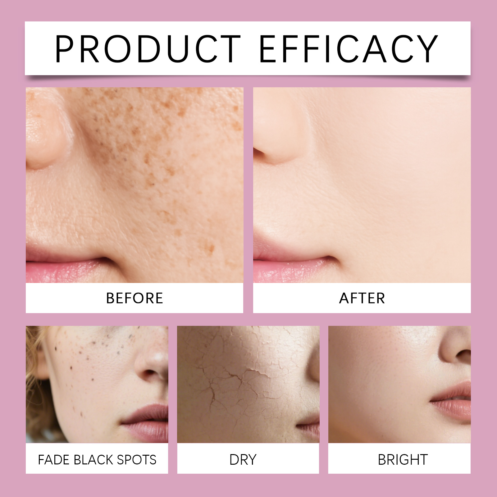한국산 칼슘 콜라겐 스킨케어 세트 나이아신아마이드 히알 - Hyaluronic Acid Facial Serum 리뷰 및 가격